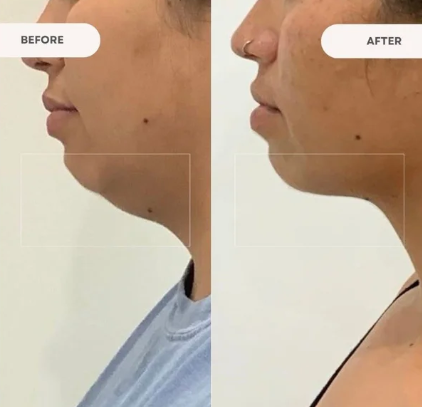 צילום מסך 2026-01-01 095737